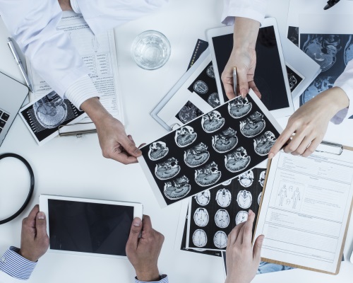 Specialists looking at a MRI test