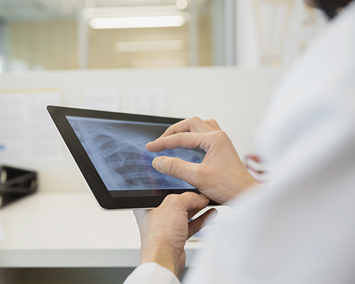 Doctor examining x-ray on digital tablet
